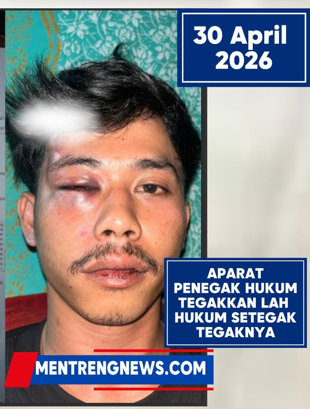 BUKTI NYATA! SOLEHUDIN KORBAN DUGAAN PENGEROYOKAN DAN PENGANIAYAAN DITUDUH MALING MOTOR