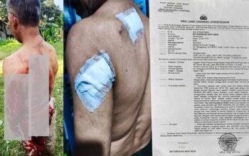 Penganiayaan Berat di Caringin Bogor: Wilson Lalengke Kecam Aksi Main Hakim Sendiri, Desak Polisi Usut Tuntas Terduga Pelaku ‘Imron’